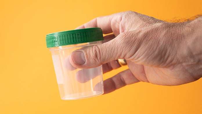 Someone holding a medical urine sample cup